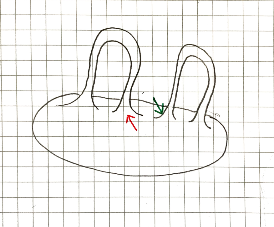 Final sigma2 surface after isotopy