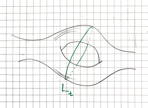 A genus-3 surface with a loop L_t shown being blocked by a hole as it attempts to move, illustrating why the isotopy fails.
